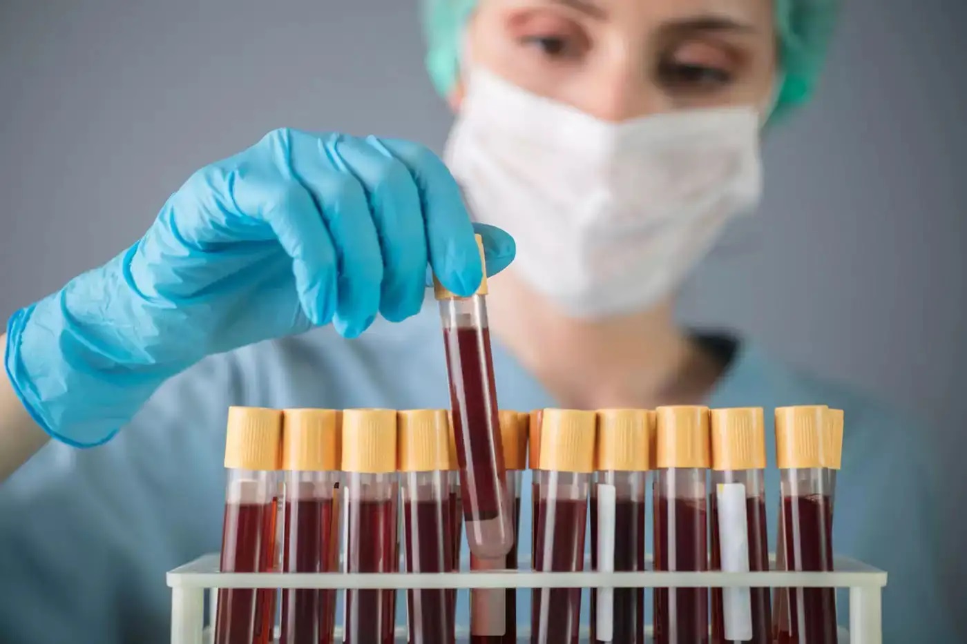 Λάρισα: Νεκρός 70χρονος κτηνοτρόφος από κρούσμα αιμορραγικού πυρετού Κριμαίας – Κονγκό